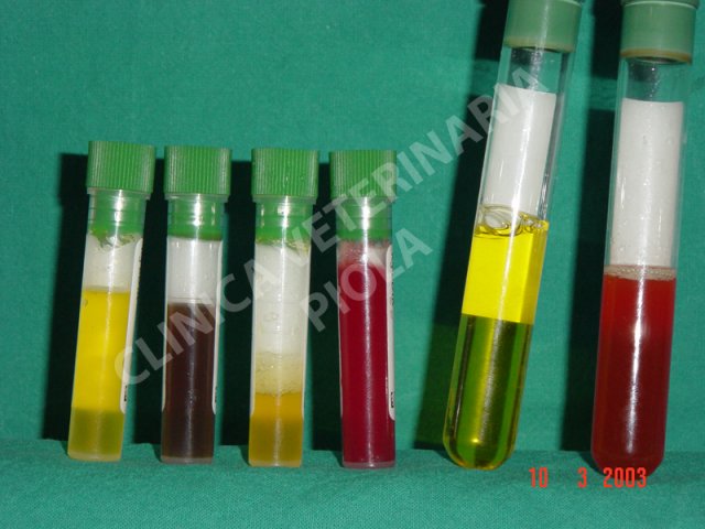 Campioni di liquido peritoneale